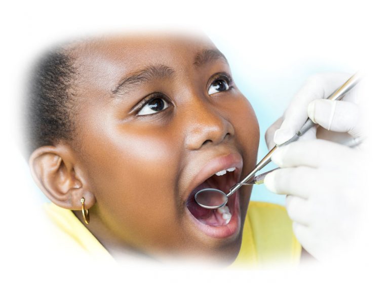 Extractions Children Dentistry Just Smilez Dental