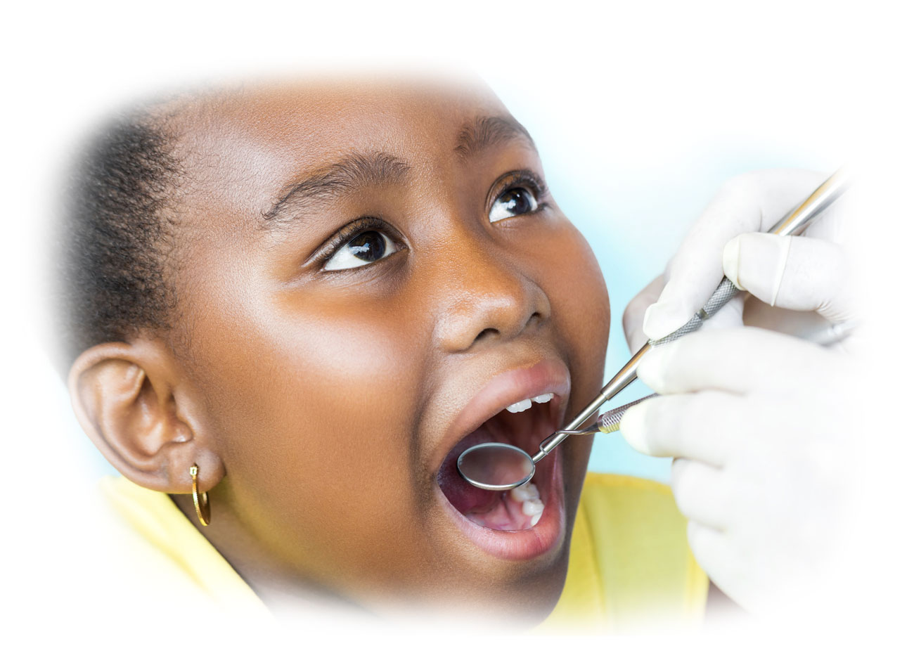 child Teeth Extraction