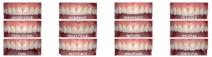 Dental Veneers