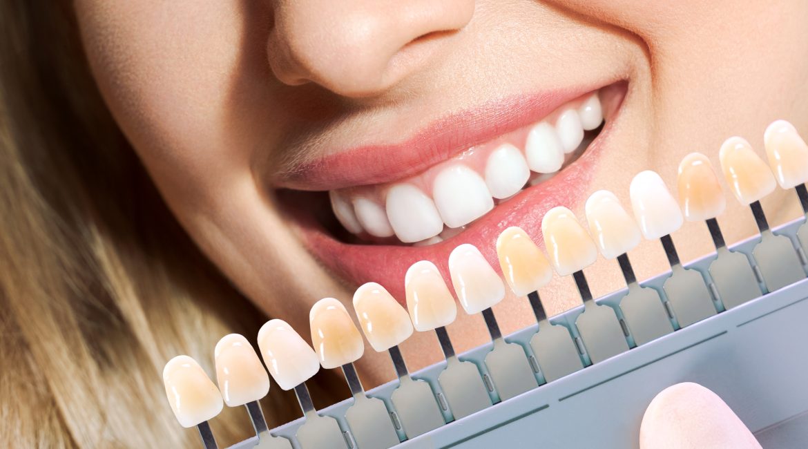 Cosmetic Dentistry Trends in Vienna: Enhancing Your Smile