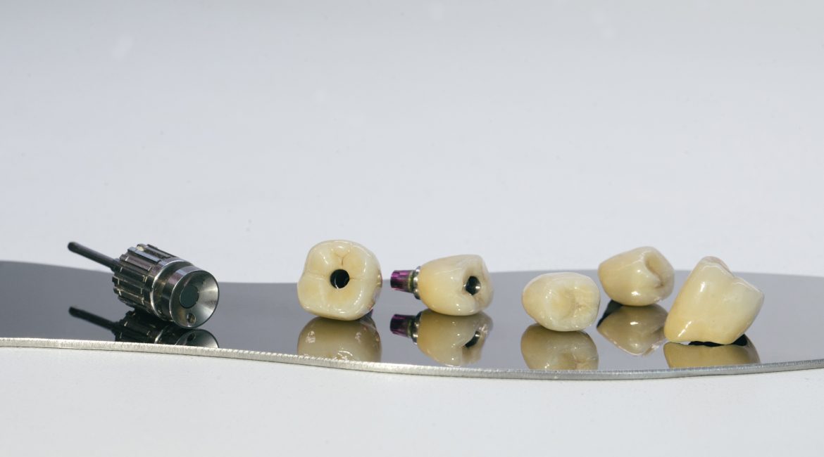Dental Crowns
