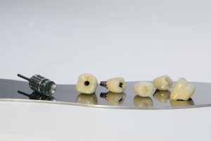Dental Crowns